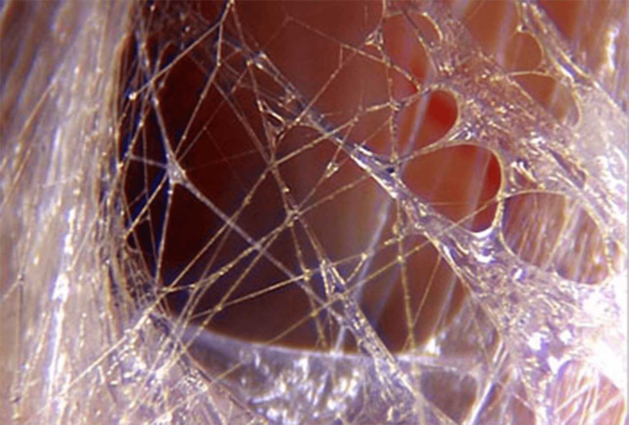 Fascia Stretch detail